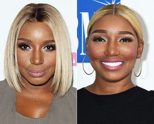 OMG! NeNe Leakes What Did You Do To Your Face?