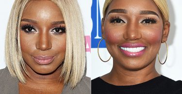 OMG! NeNe Leakes What Did You Do To Your Face?